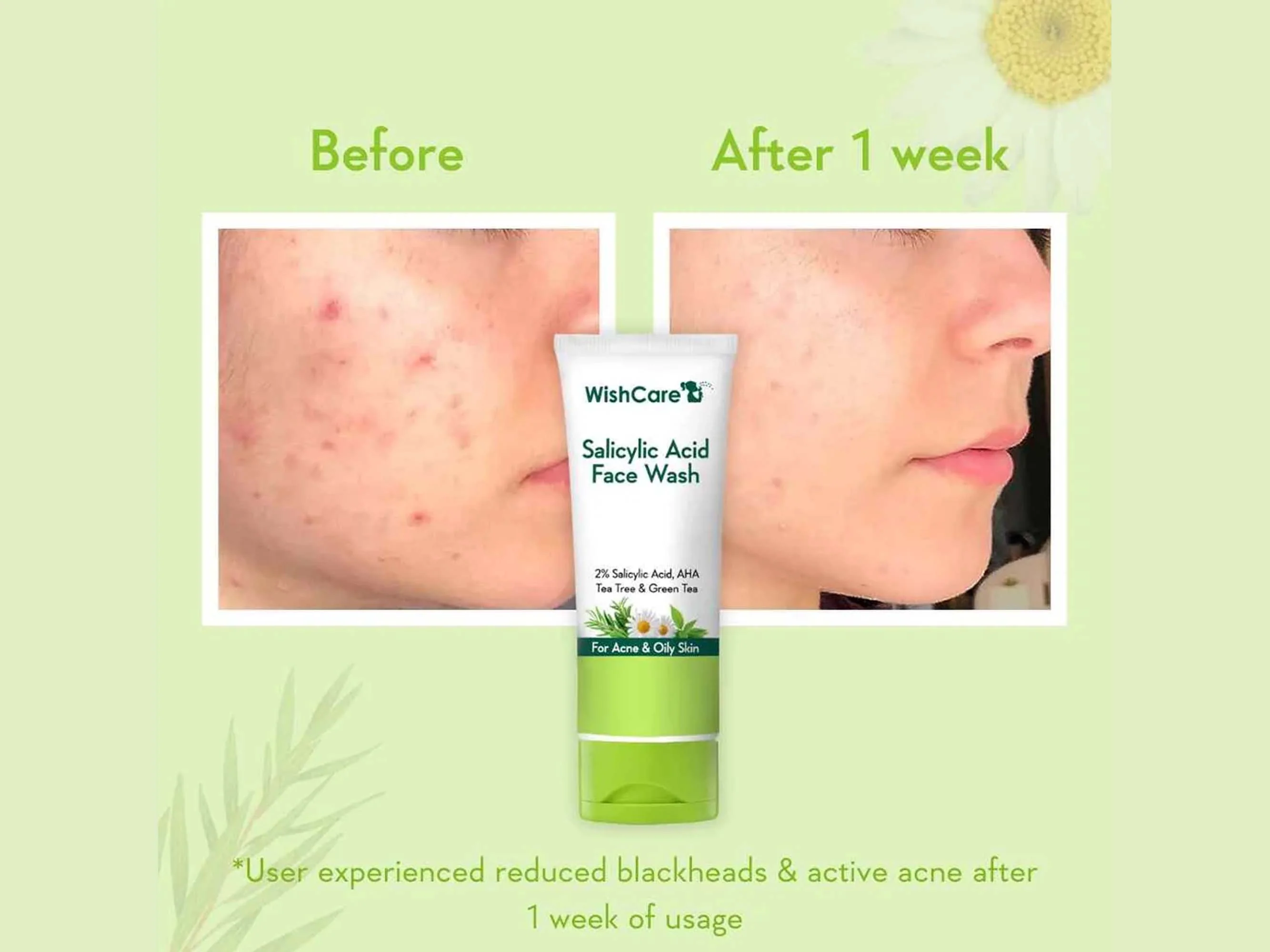 WishCare Salicylic Acid Face Wash - Image 5
